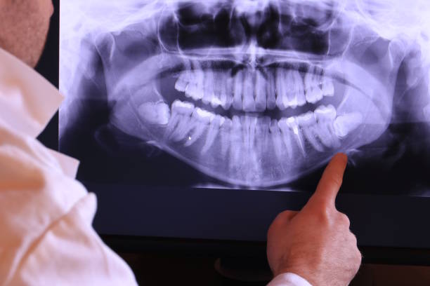 Best Root Canal Emergency Dentist  in Juneau, WI